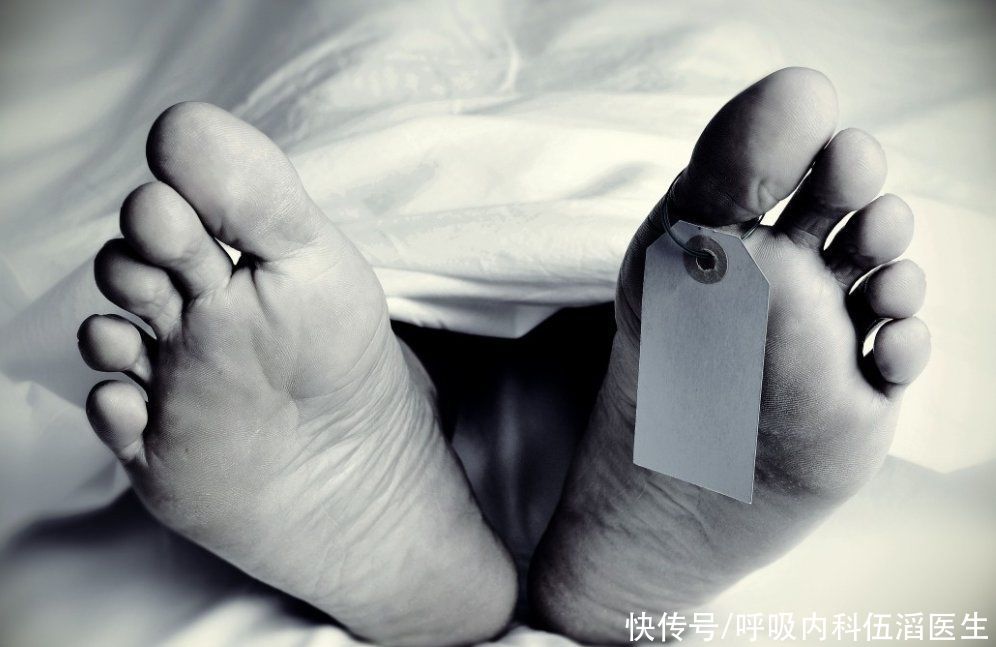 肺癌早期|医生:这种咳嗽,是肺癌早期的第一个高危信号,还很容易被忽视掉