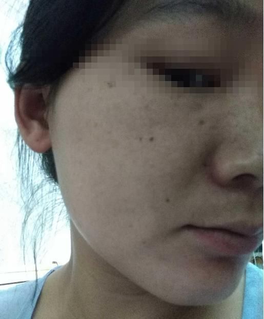 宝宝|怀孕之后肚子上浮现一条“黑线”,妈妈嫌丑婆婆嫌细,别再迷信了