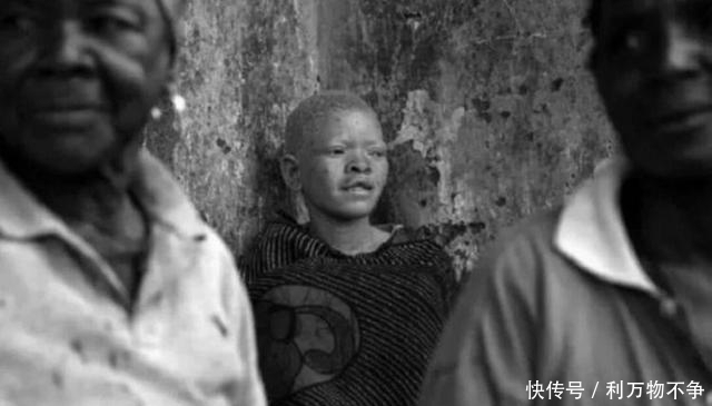 治愈|被人当成“唐僧肉”,血液比金子还贵,警察只能24小时保护他们