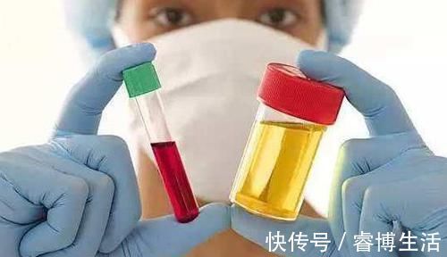 痛风|天然的“降酸王”,每天来几口,能帮助你排泄尿酸,远离痛风!