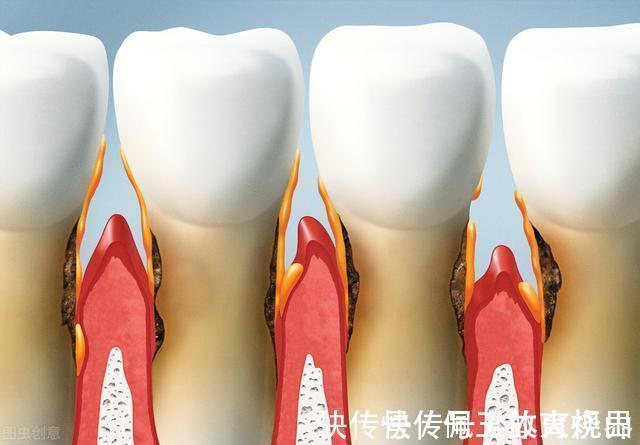 预防老年痴呆|60岁后，老年人在生活上，尽量少做这3件事，对健康有好处