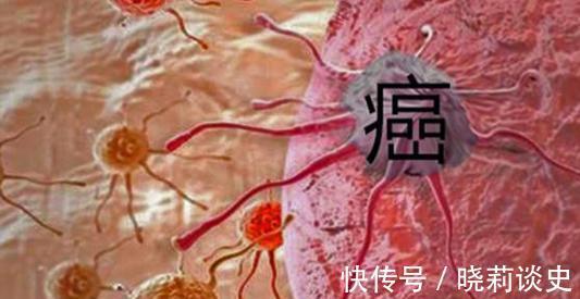 癌痛|癌症晚期太痛,又不想吃药,怎么办?专家指出三条路,或可试试