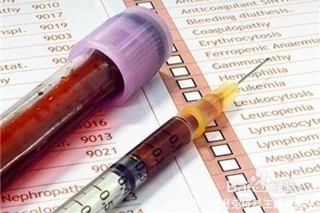 患者|类风湿精准检查,让患者少走弯路!