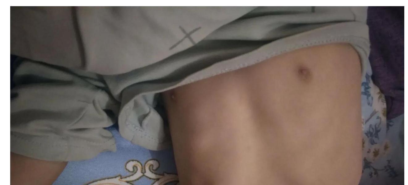 脾虚|孩子瘦弱不长肉,妈妈:等长大点就好了。儿科医生:极其不负责任