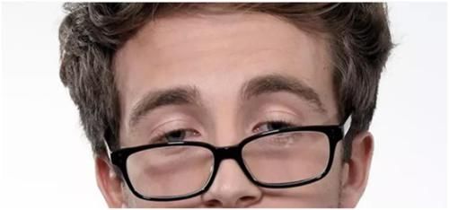 上睑下垂眼无神,做个双眼皮手术就能搞定吗?