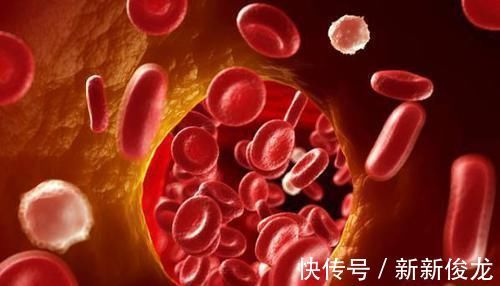 实邪|张仲景一个神奇的配方,5味药,疏通气血,搞定从头到脚的麻木