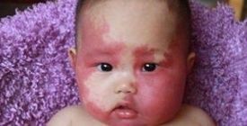 怀孕期间|怀孕期间,这几件事最好别做,容易在宝宝身上留下胎记。