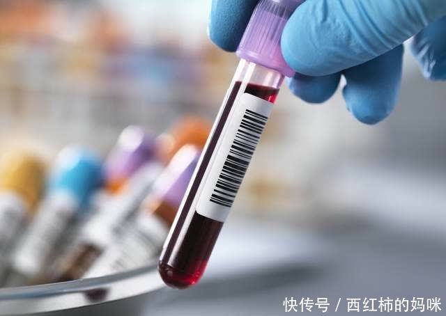 准妈妈|孕期产检“唐筛”和“糖筛”项目名称相似,可检查的目的大不同