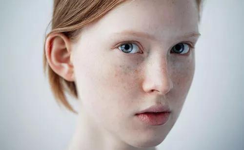 你知道干性皮肤该怎么保养吗?快进来做笔记