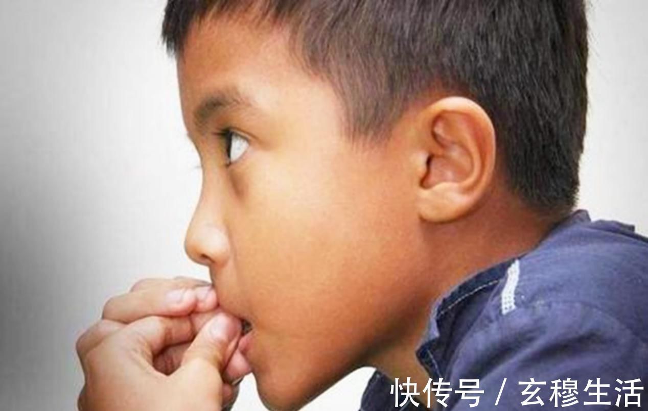 性格|一咬指甲就咬到“秃”的孩子,长大不仅影响性格,还影响身体健康
