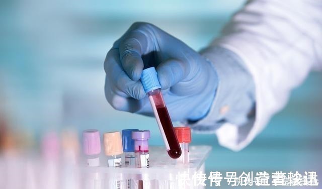 特点|战胜癌症靠运气?肿瘤专家表示,抗癌成功的人都有这4大特点