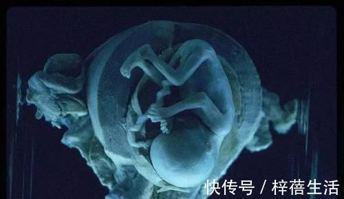 小鸢|怀孕37周照B超,医生称不要顺产主任一分钟轻松搞定