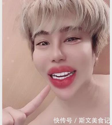 艾伦|日本一帅气小伙花1亿做全身整容，最后终于整成了“悲伤蛙”