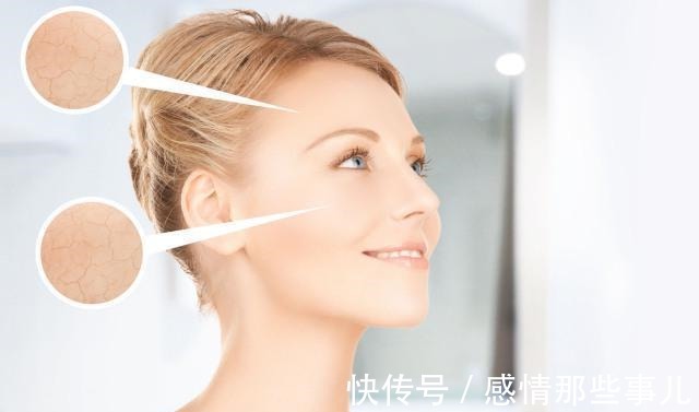肌肤|容易长斑的七种女性，有你吗做好这些护理可快速缓解色斑！