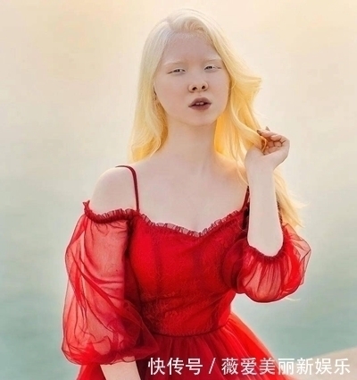 白化病|一对罕见的“月亮姐妹”,被人嘲讽14年,拍完一组照片后惊艳众人