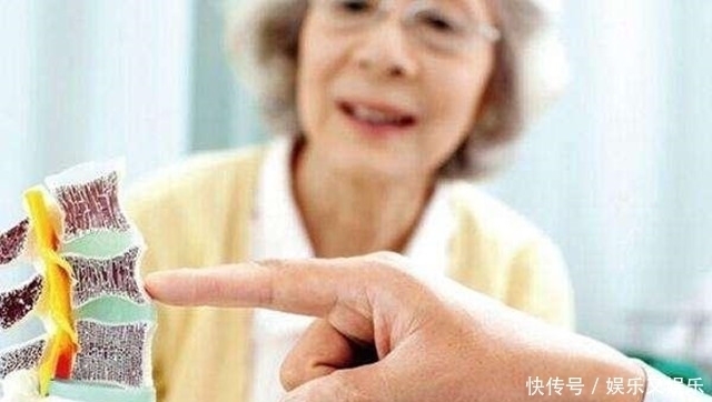 偷钙食物|女性45岁后想预防骨质疏松,3种偷钙食物要少食,多做3事