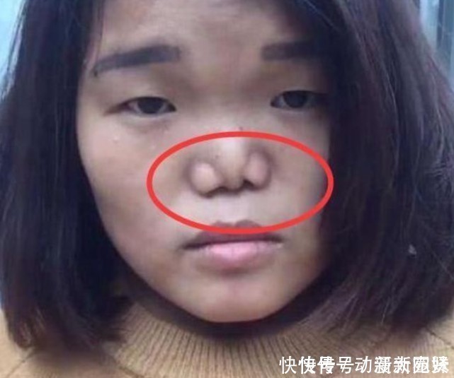 被公认的3种“丑鼻子”,中了颜值不会太高,没中的小仙女偷笑吧