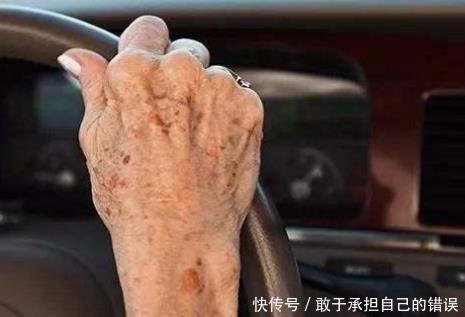 最新版|为何有的人老年斑一大片,有的人却没有呢告诉你背后真正的原因