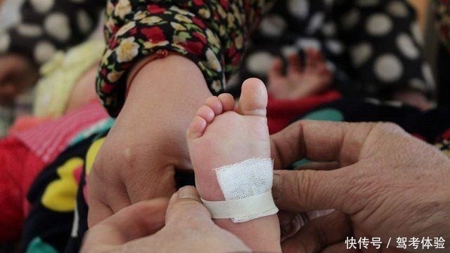 孩子|宝宝身上长“黑刺”,妈妈嫌难看一根根拔掉,第二天直接送医院!