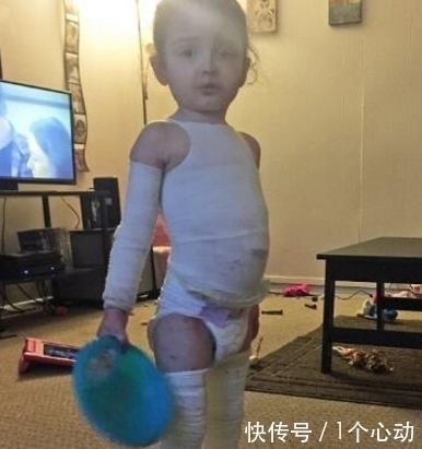 lily|3岁女孩患怪病,摸一下都有可能被杀,妈妈天天把她包成木乃伊