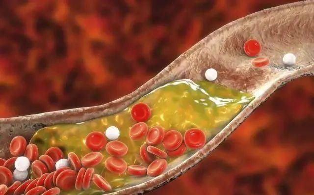 高血糖|血糖超标,“脚”知道?双脚若没有4异常,祝贺,血糖控制得不错