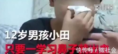 同学们|12岁男孩患“怪病”,一学习就流鼻血,网友:同学们都很羡慕你吧