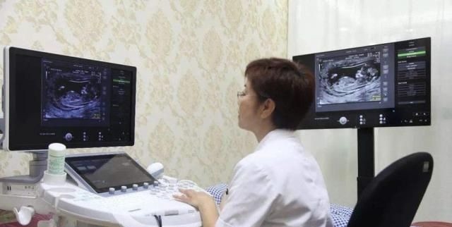 胎儿|按时产检却生下“畸形儿”这些问题检查时很难发现,孕妈要知道