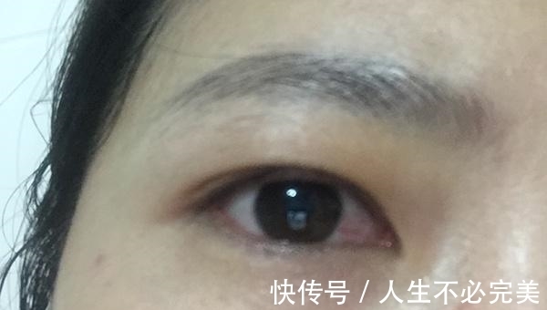 并发症|患上糖尿病却没当回事?身体可能慢慢出现三种变化,要多注意