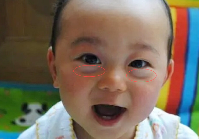 积食|脾虚积食的“克星”找到了,不想孩子变矮个,家长们请重视!