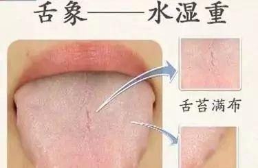  果你|免疫力是长寿关键，到底该如何加强自己免疫力？你的舌头知道答案