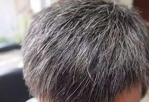 经常按摩身体这6个部位,不仅能防病养生,还可