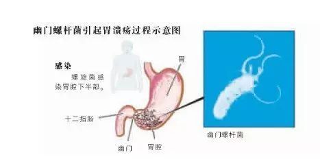 分餐制|知名男星治病冲上热搜！