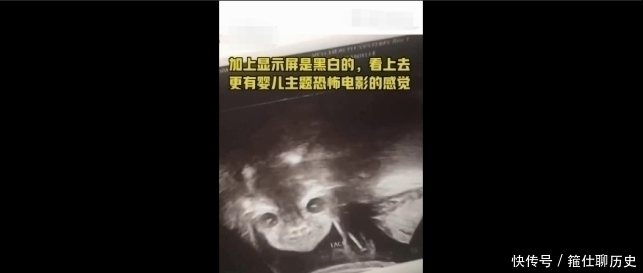 医生|孕妇做B超被吓坏，孩子突然睁眼怪笑！医生却说……