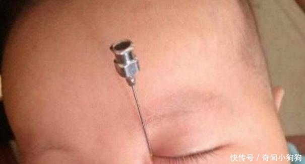 半岁女孩发烧, 医生将针扎入眼角, 眼角流出液体, 母亲无法淡定