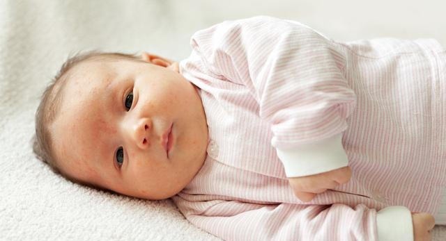 母乳|当孩子有这些反应的时候,就证明你的母乳不合格,宝妈就要忌口了