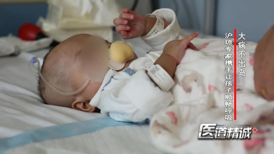 小芊芊|大病不出岛 海南首例5个月婴幼儿气道狭窄成形术