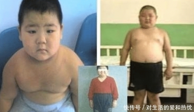 医生|5岁男孩体重90斤，妈妈怀疑孩子生病，送医检查后，医生乐了
