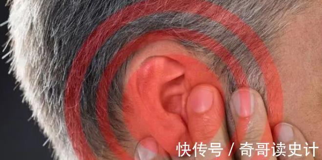 血脂|高血脂“帮凶”已找到,脸上有这3异常,多半血脂已超标,早就医