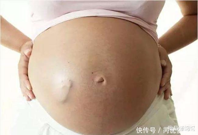 剖腹產|同樣是“一刀”,側切和剖腹產區別有多大?這7大區別你未必想得到