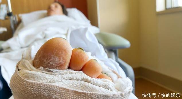 你知道影响骨质疏松有哪些因素吗医生告诉您