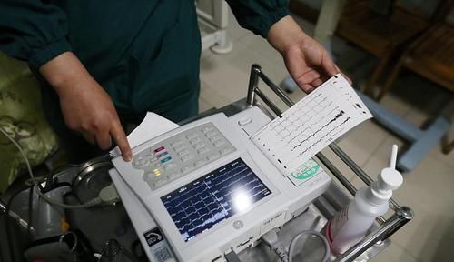 想体检,不知道该查什么?提醒:日常体检查这4项或许就够了!