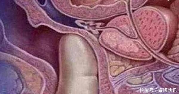 产房|产前内检很尴尬，这项检查能取消吗听听医生怎么说