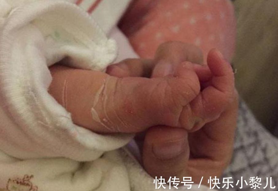 医院|宝宝出生后为啥要先按“足印”?医院的这些考量,家长要清楚