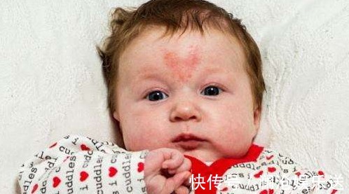 后生|孕妇十月怀胎后生下个“藏獒”,医生得知原因后,怒斥孕妇没人性