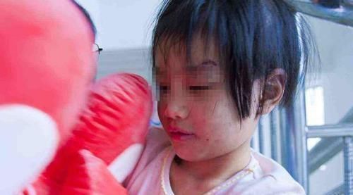 虐待|3岁女孩没照顾好弟弟，被母亲暴力教育，大口吐血却仍要抱抱