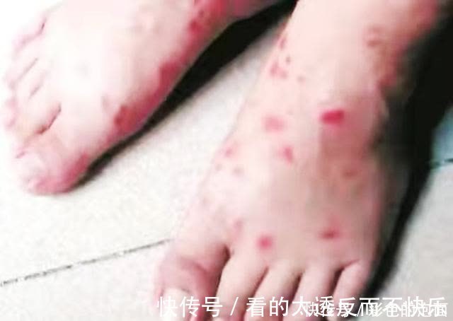 蚂蚁|钓鱼时,它不会影响渔获,但会影响钓友的安全