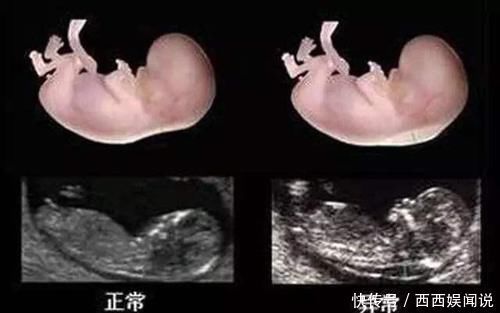 产检|怀孕40周做十多次产检都有必要吗?四项产检认真做,关乎胎儿健康