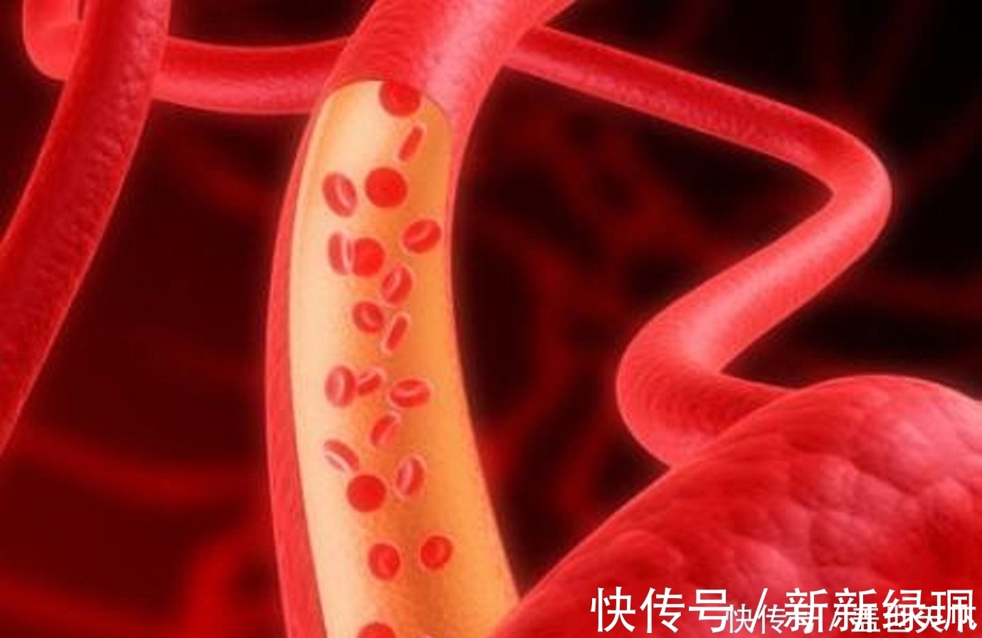 血脂|血脂四项中只是甘油三酯偏高，其它三项正常，这说明了什么问题？