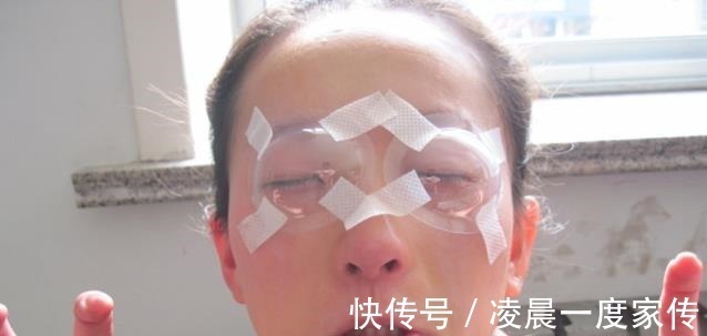 手术|曾用激光手术治疗近视眼的人,如今眼睛怎么样了有后遗症吗