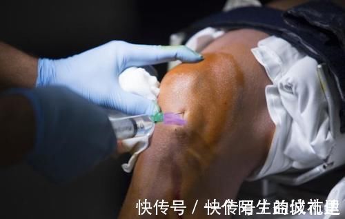 关节|得了膝关节炎,打玻璃酸钠到底管不管用?骨科医生告诉你答案